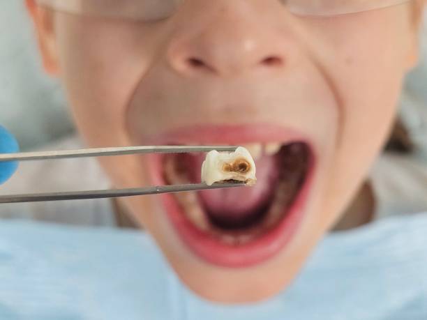 Emergency Dentist for Kids in WV